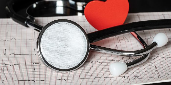 Differenze tra ECG e ecocardiogramma