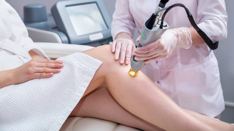 epilazione laser medica o estetica